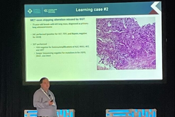 Presentor at CB Exchange showing a slide labeled: Learning Case #2